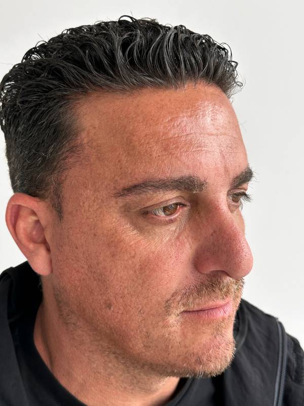 anterior de cliente sin cejas