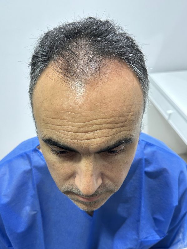 Cliente satisfecho con pelo