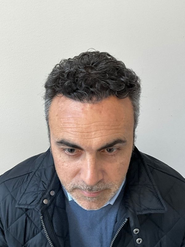 anterior de cliente sin cabello