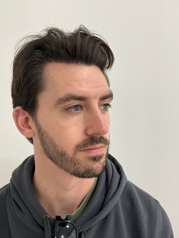 anterior de cliente con cabello