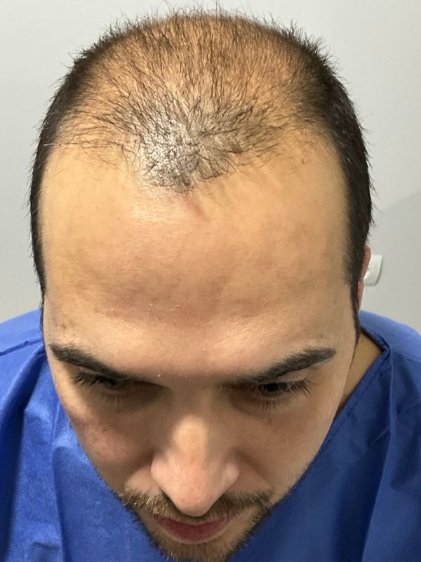 Cliente satisfecho con pelo